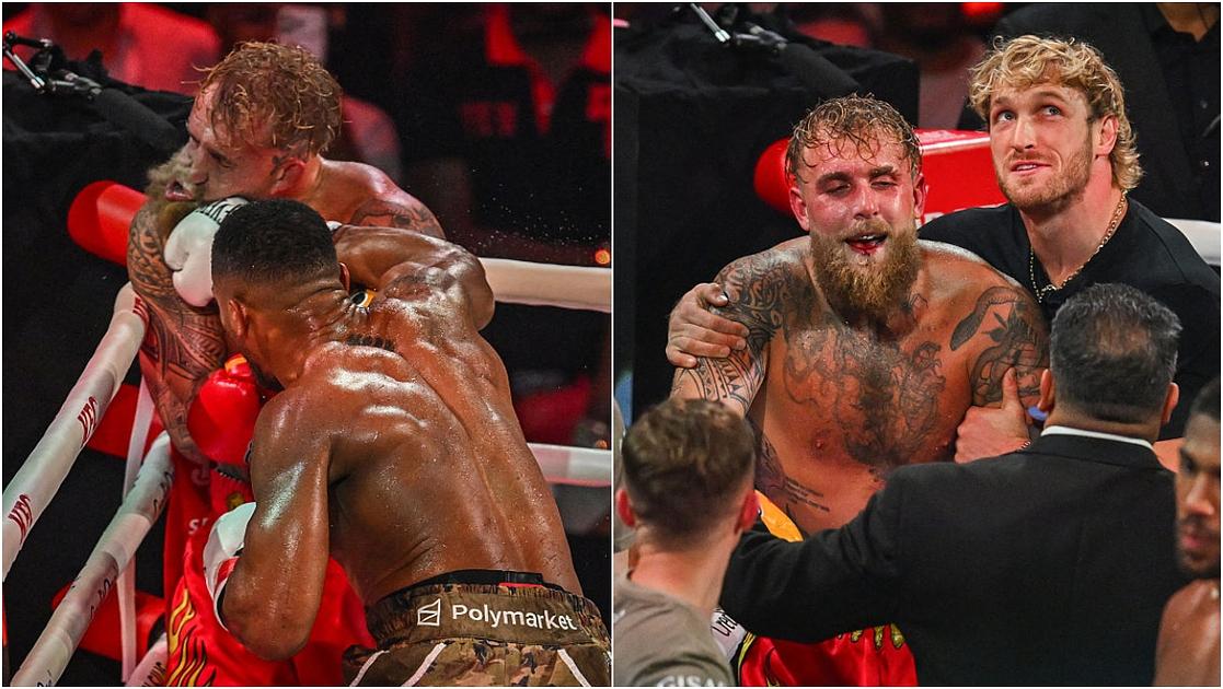 Jake Paul Undergoes Surgery for Double Jaw Fracture After Knockout Loss to Anthony Joshua