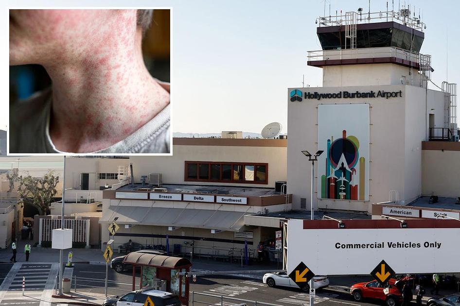 Measles exposures traced through multiple U.S. airports, including Burbank