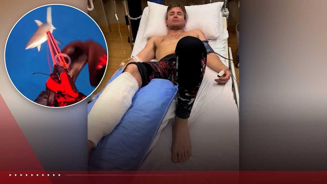 New Zealand Diver Urges Shark Safety After Fiji Attack