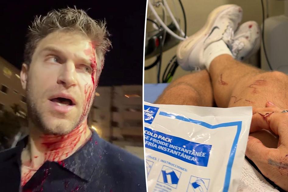 Actor Keegan Allen Hospitalized After West Hollywood Armed Robbery