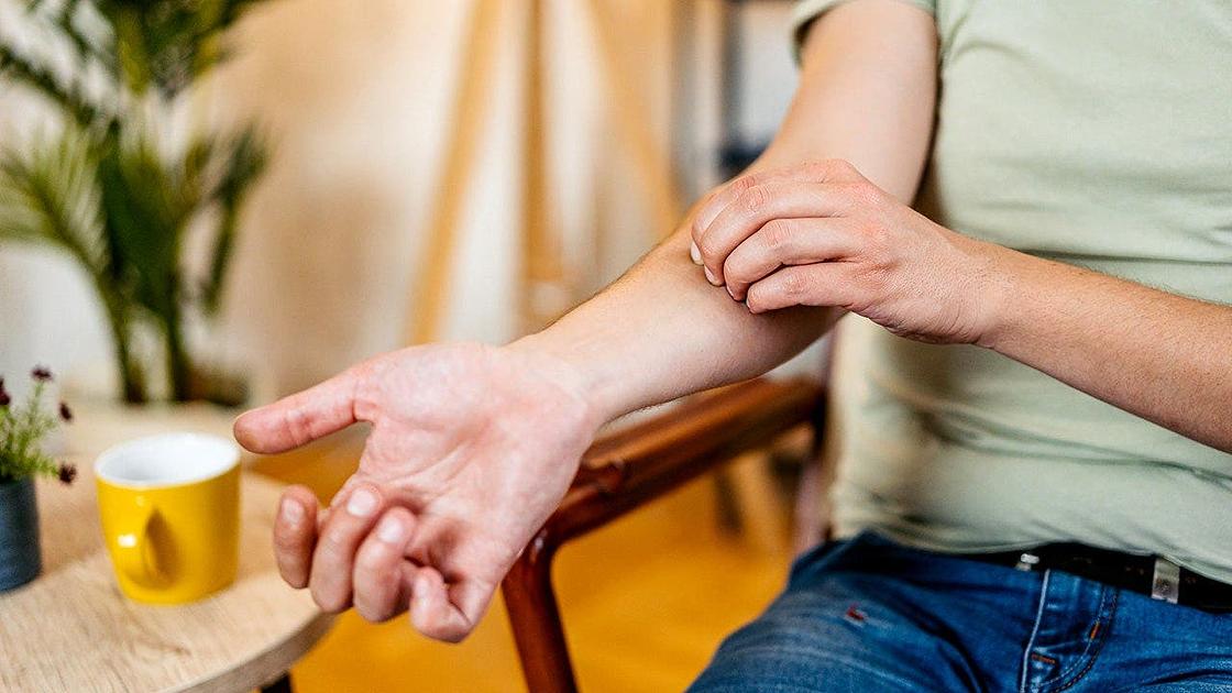 University of Pittsburgh Study Links Scratching to Heightened Eczema Inflammation