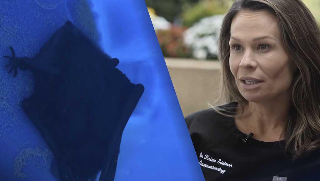 Virginia doctor traps bat that entered her mouth, urges rabies precautions