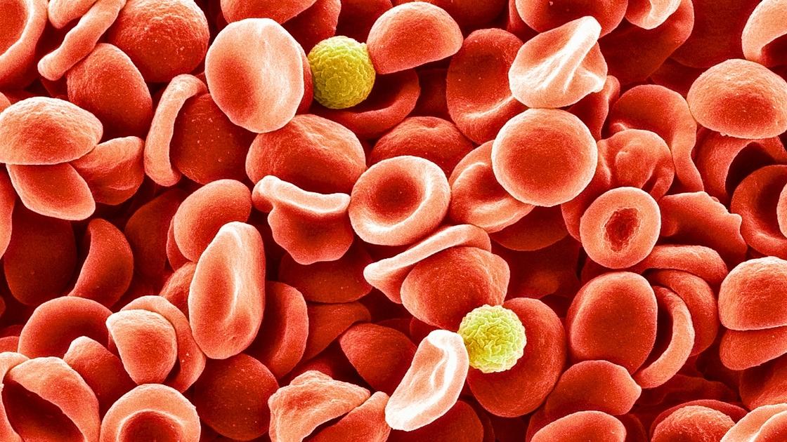 Researchers Identify MAL Blood Group, Resolving 50-Year AnWj Antigen Mystery