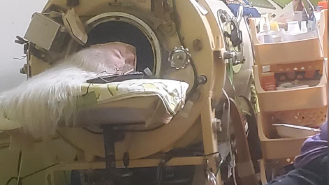 Last U.S. Iron-Lung Polio Survivor Martha Lillard Dies at 78